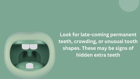 Hyperdontia (Extra Teeth in Kids)