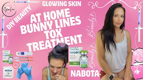 BUNNY LINE TOX with NABOTA