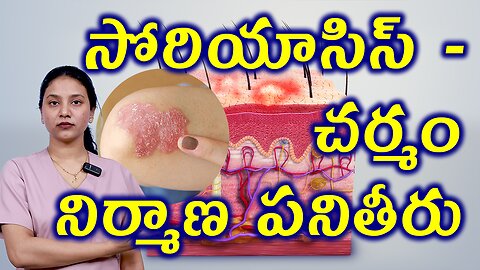 సోరియాసిస్ - చర్మం పనితీరు Structure and Function of Skin Related to Psoriasis Homeopathy Treatment