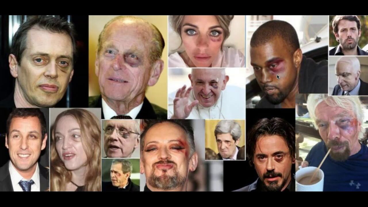 WHY the black left eyes on Celebrities? The Black Eye Club and WWF land theft and Panda Bears