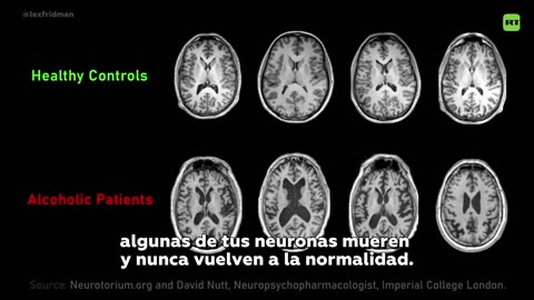 ⁉️¿El alcohol convierte en "zombis" a tus neuronas?