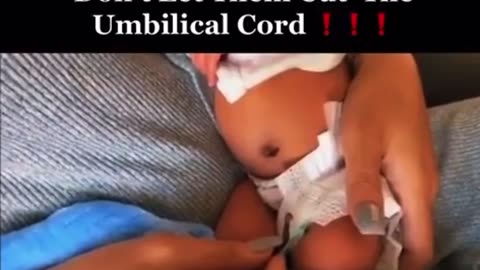 Don’t Let THEM CUT the UMBILICAL CORD ‼️