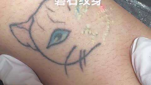 Satisfying tattoo removing process