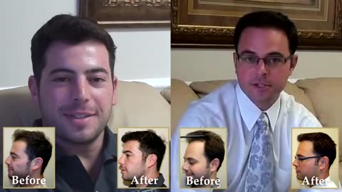 Dr. Brett Bolton – A Tale of Two Brothers, One Life-Changing Hair Transplant