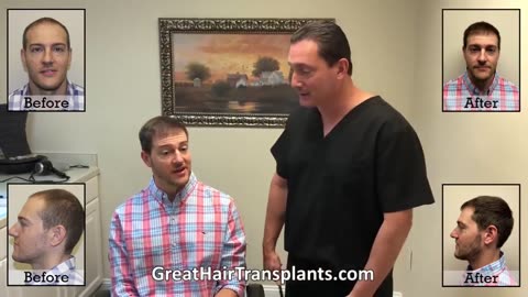 Life-Changing Hair Restoration Achieved in Just One Procedure
