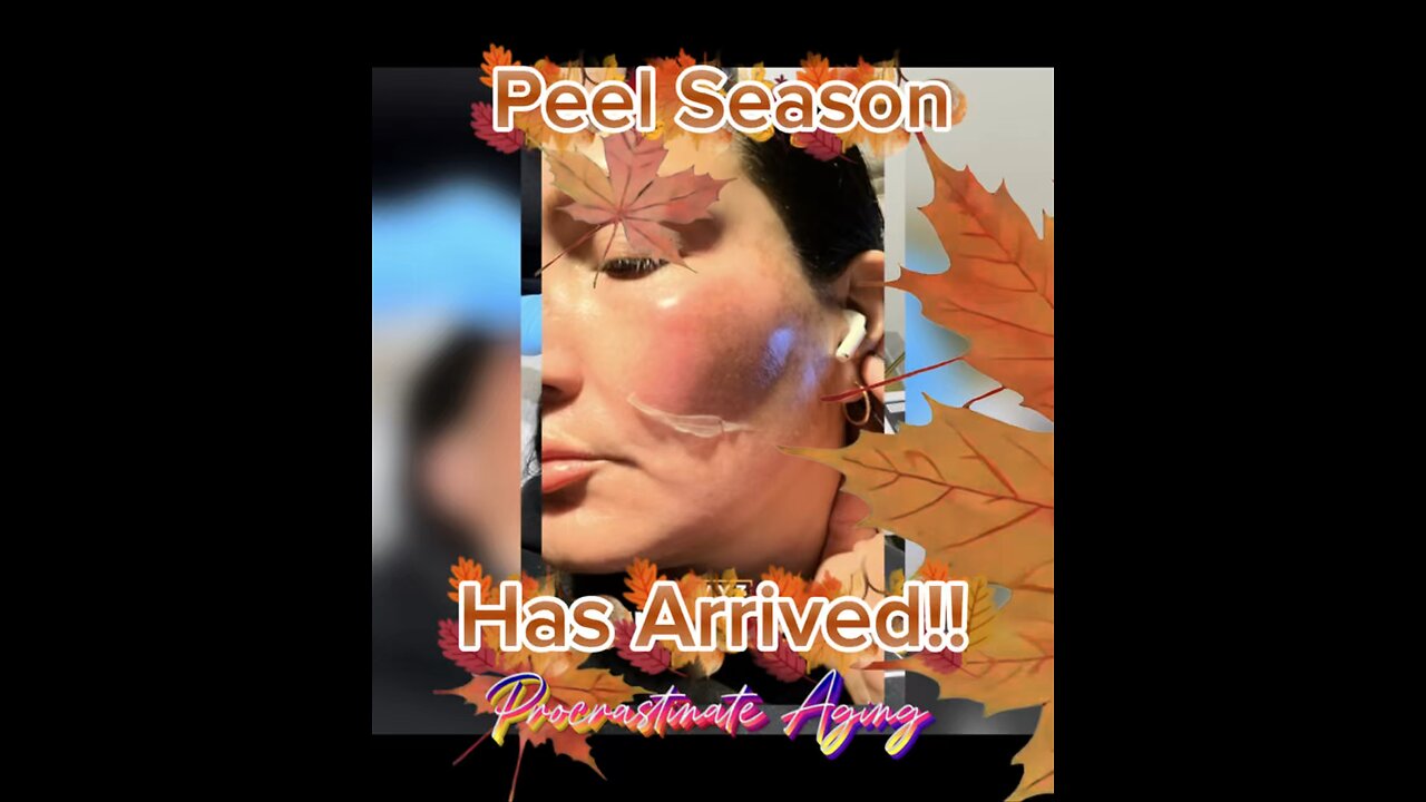 You Guys.. Peel Season Has Arrived 💁🏻‍♀️Acecosm - Beautiejunkie10