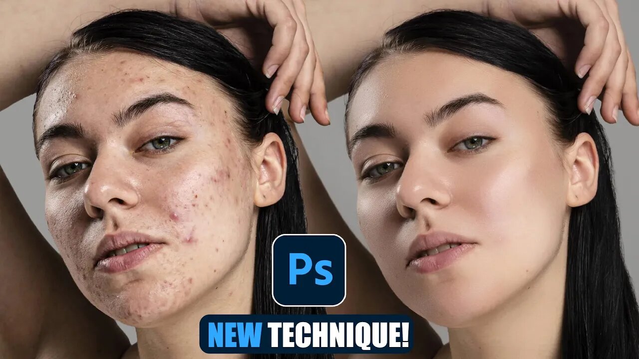 Flawless Skin in Minutes: Beginner's Guide to Removing Acne in Photoshop (2024)"