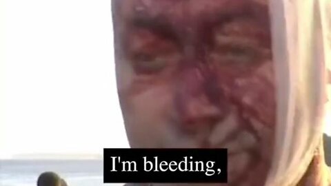 False flags to manipulate retarded goyim bondi