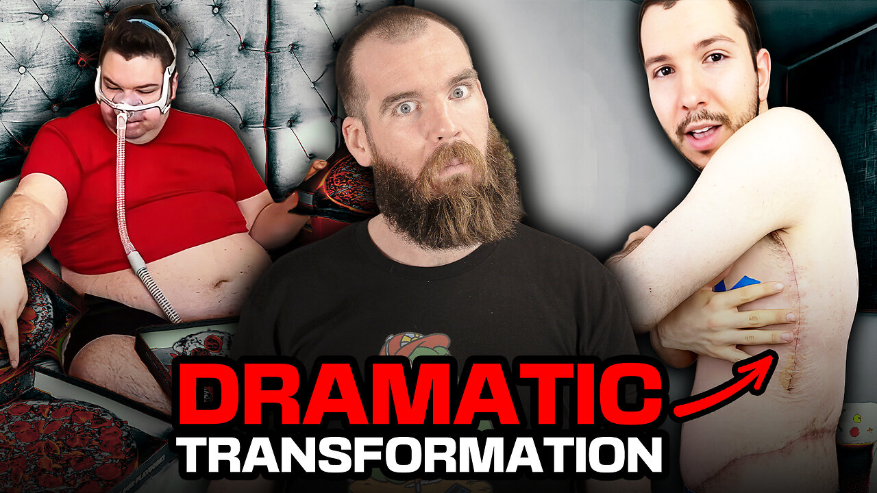 Nikocado Avocado’s CRAZY WEIGHT LOSS SURGERY!