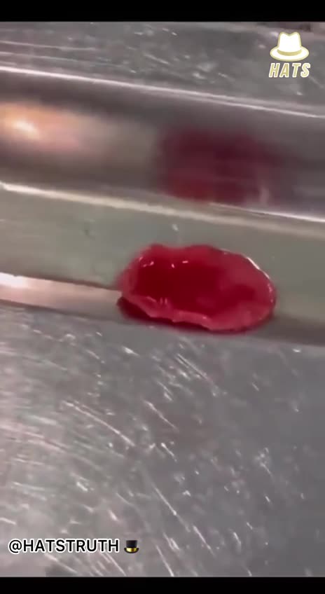 מטורף חתיכת כבד שהוצאה מבנאדם שעשה חיסוני קורונה למה הוא זז למה הוא זז