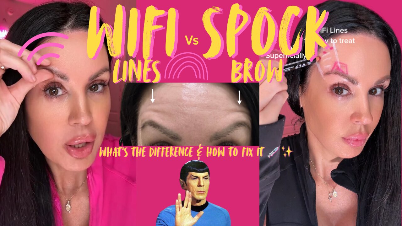 WiFi Lines VS Spock Brow What’s The Difference & How To Fix It