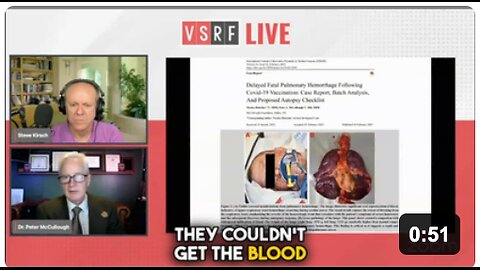 Vaccine Aftermath: 555 Days Later