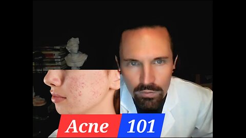 Acne 101 The Basics