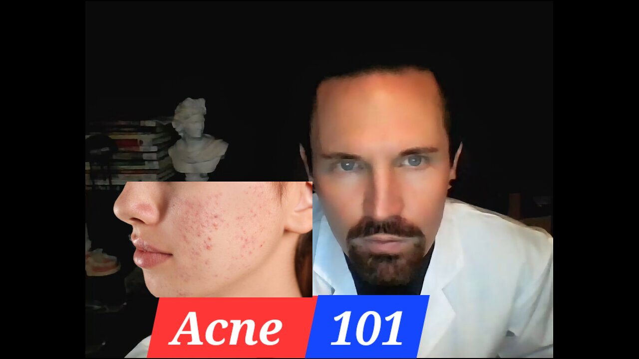 Acne 101 The Basics