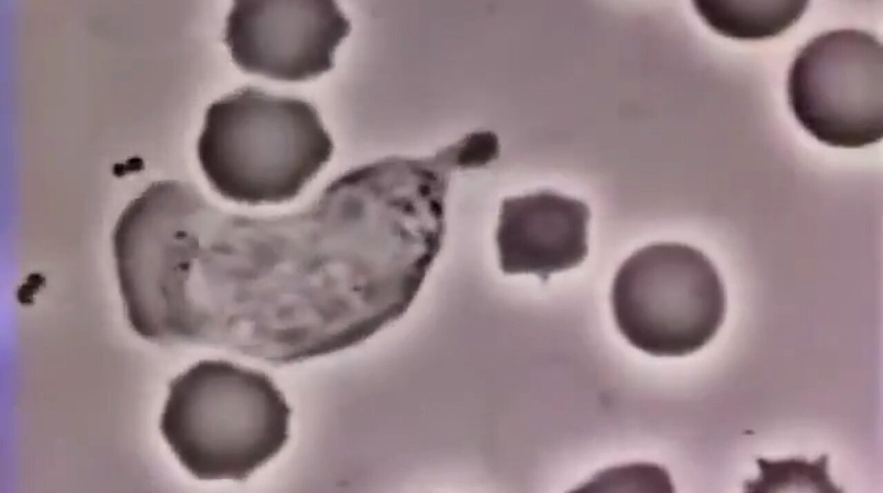 A HUMAN WHITE BLOOD CELL CHASING A BACTERIUM ✨