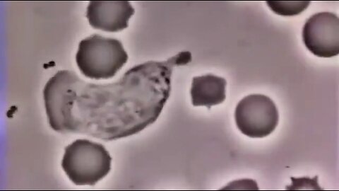A HUMAN WHITE BLOOD CELL CHASING A BACTERIUM ✨
