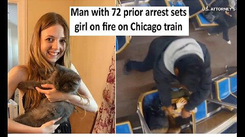 Girl set on fire, alleged perpetrator has 72 prior arrest