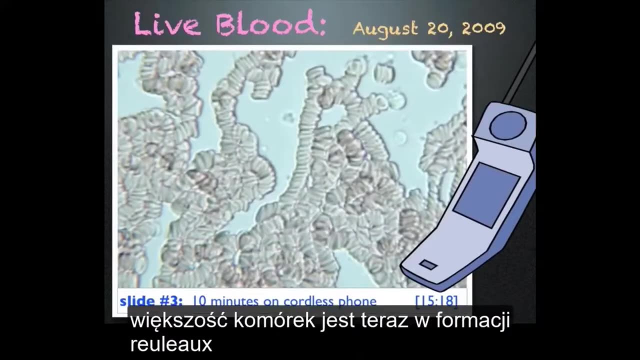 Jak wpływa promieniowanie smartfonu na organizm ludzki (sklejanie krwi!)