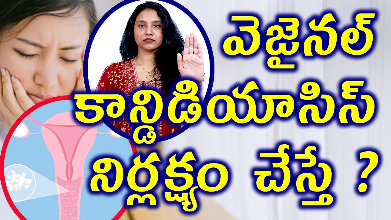 వెజైనల్ కాన్డిడియాసిస్ నిర్లక్ష్యం చేస్తే If vaginal candidiasis is neglected Homeopathy Treatment