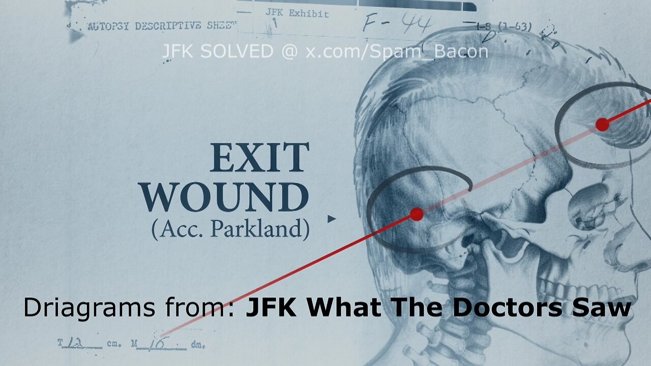 The Paramount+ JFK documentary inadvertently proves the driver shot JFK