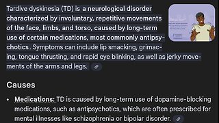Acute dystonia & Tardive Dyskinesia.