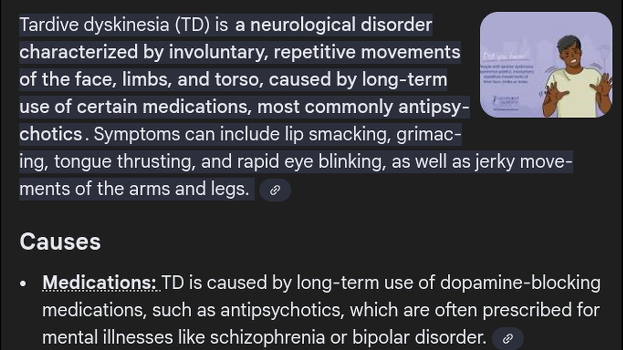 Acute dystonia & Tardive Dyskinesia.