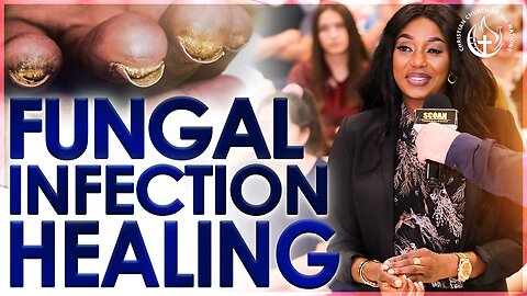 Woman With Severe FUNGAL INFECTION Got HEALED THROUGH PRAYER!!! 🙏