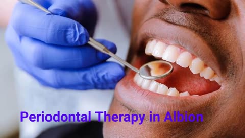 Albion Family Dental Care - #1 Periodontal Therapy in Albion, NY