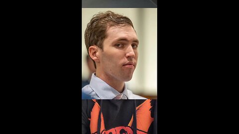 They changed the shape of his skull lol