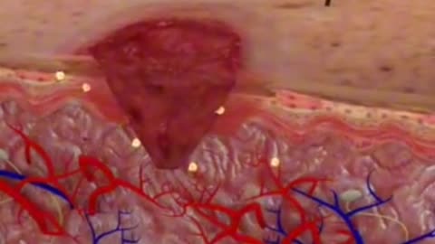 Wound Healing Process Timelapse 3D Animation