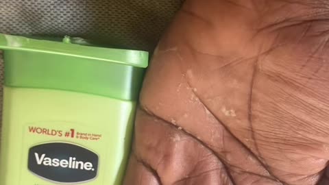 Vaseline vs dry hands