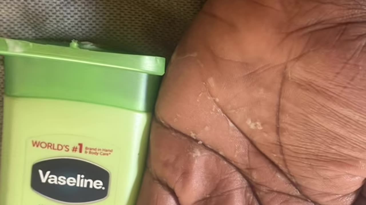 Vaseline vs dry hands