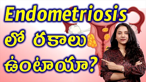 ఎండోమెట్రియోసిస్ లో రకాలు ఉంటాయా? Types of Endometriosis Treatment Medicine | హోమియోపతి