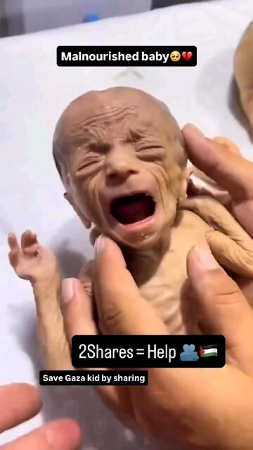 please save Palestinian child 🙏 🤲