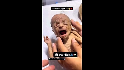 please save Palestinian child 🙏 🤲