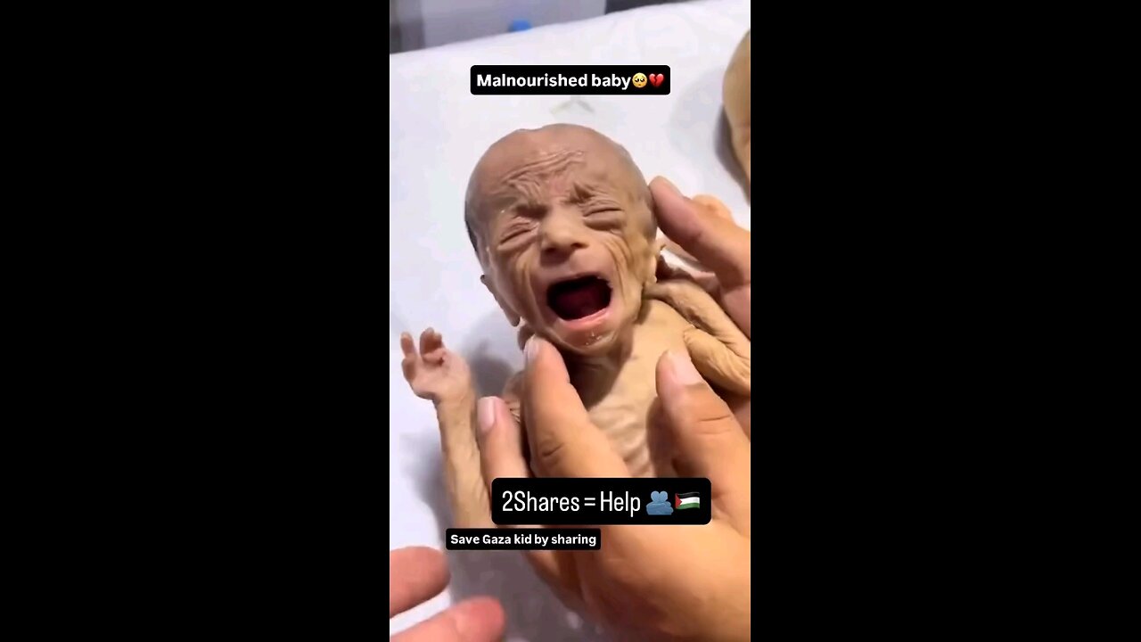 please save Palestinian child 🙏 🤲