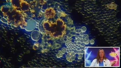 Dr. Ana Maria Mihalcea AZK presentation 2025