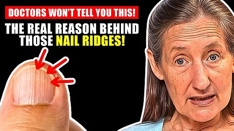 Barbara O'neill | That's The REAL Cause of VERTICAL RIDGES On Your Nails