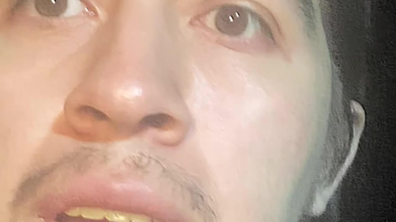 Reduce endotoxin for digestion by Ed Delacruz #health #healthy #healthadvice #reels #shorts