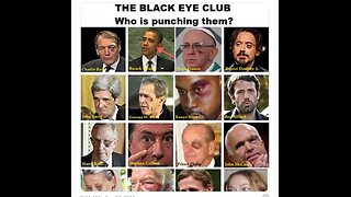 The Black Eye Club !!