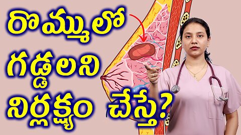 రొమ్ములో గడ్డలని నిర్లక్ష్యం చేస్తే? What Happens if You Neglect Fibroadenoma? Homeopahty Treatment