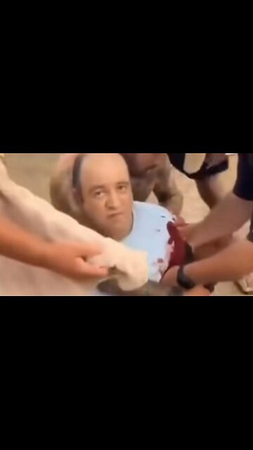 Ahmed Al Ahmad Seems Fully Conscious And Bored After Getting Shot Twice. Bondi Hoax