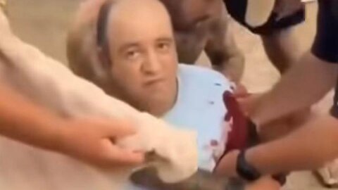 Ahmed Al Ahmad Seems Fully Conscious And Bored After Getting Shot Twice. Bondi Hoax