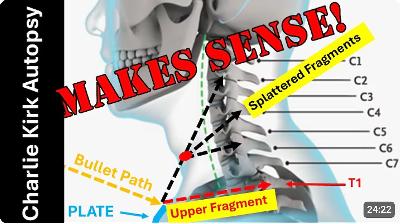 Former Police Firearms Instructor Dick Fairburn Tries to Make Sense of Charlie Kirk Autopsy Findings
