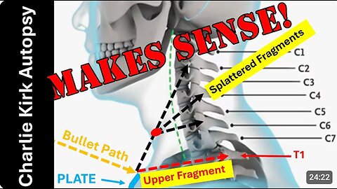 Former Police Firearms Instructor Dick Fairburn Tries to Make Sense of Charlie Kirk Autopsy Findings