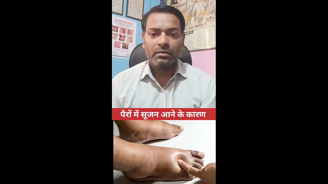 पैरों में सूजन आने के कारण ।