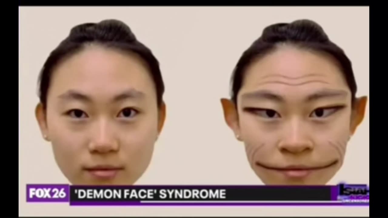 Demon face "syndrome"