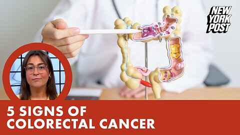 5 signs you may have colorectal cancer