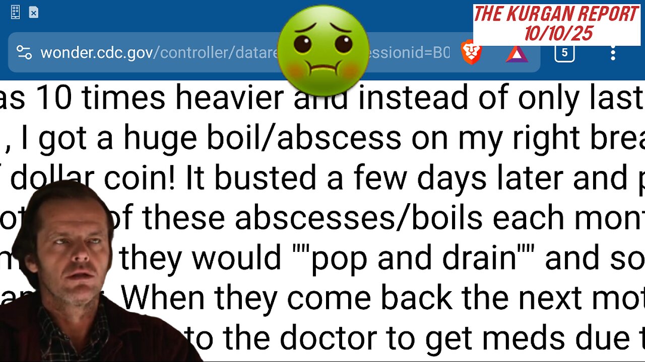 VAERS: THE TASTIEST CASE I'VE EVER SEEN!