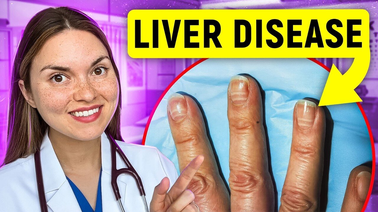 12 Signs of LIVER DISEASE You Can See: Doctor Explains